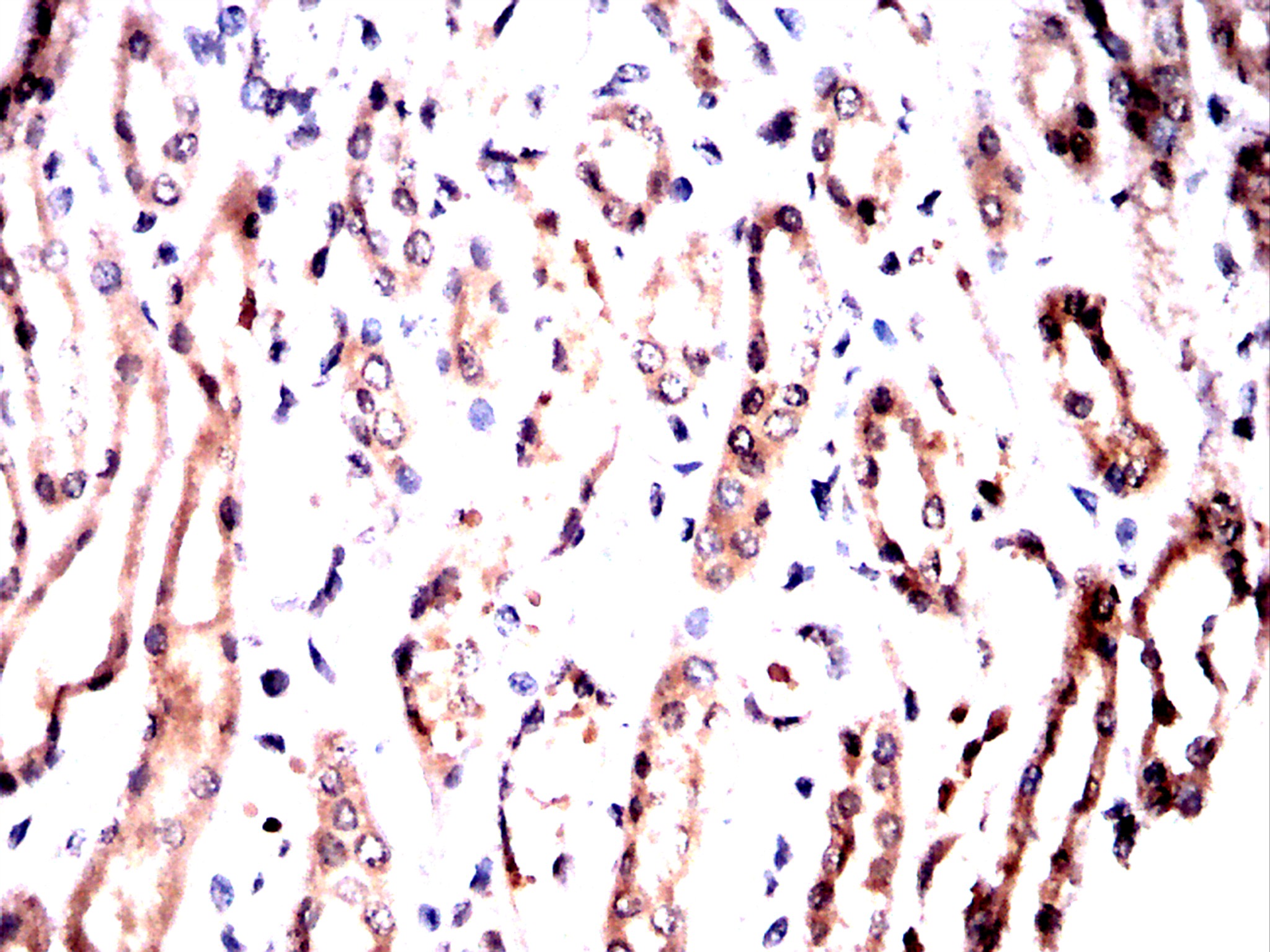 IHC 